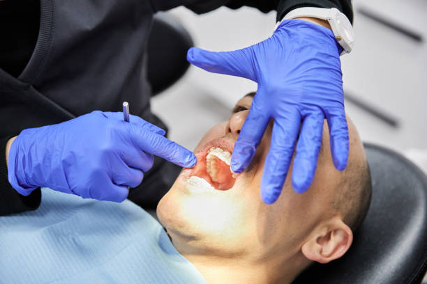 Best Emergency Denture Repair in Norton, OH