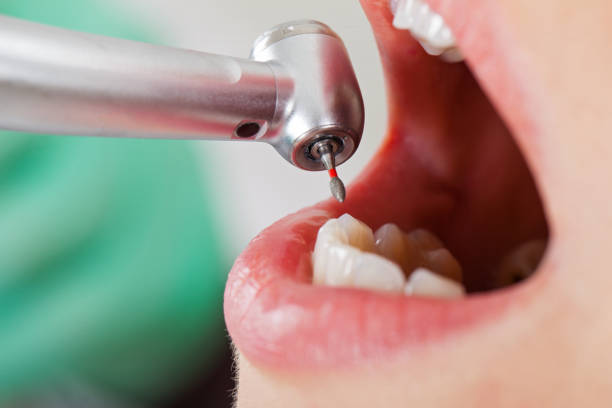 Best Pediatric Emergency Dentist in Norton, OH